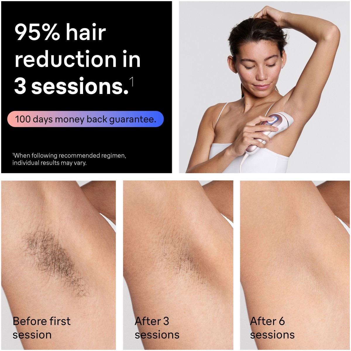 Braun - Smart IPL Skin i·expert Ontharing voor thuis, met app, 2 slimme opzetstukken - Wit/Bronze — foto 6