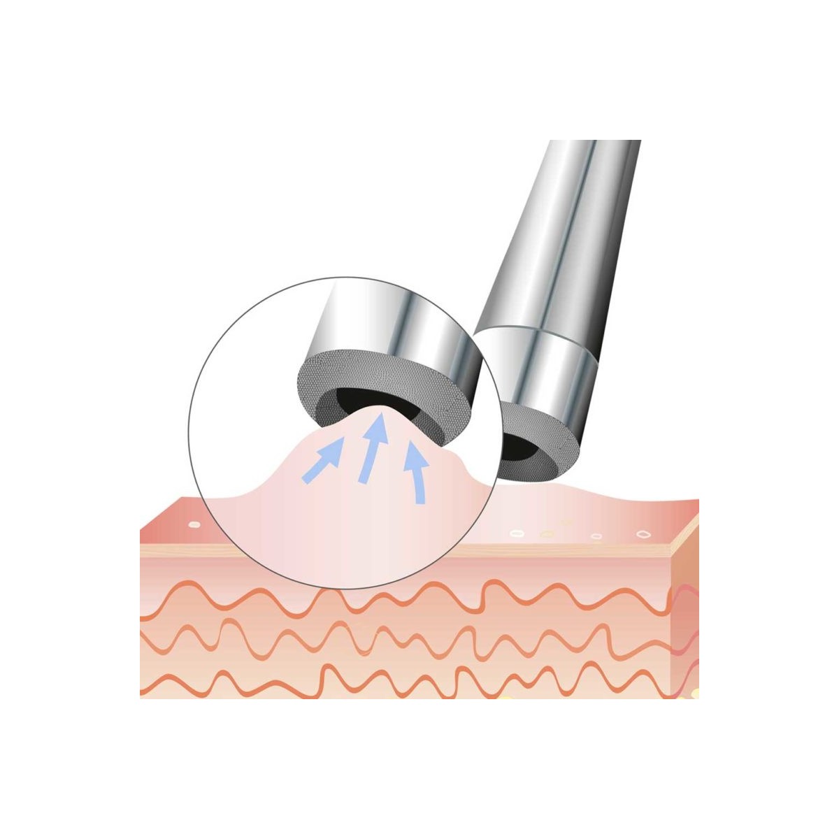 Beurer - FC 100 Pureo Derma Peel Microdermabrasie — foto 3